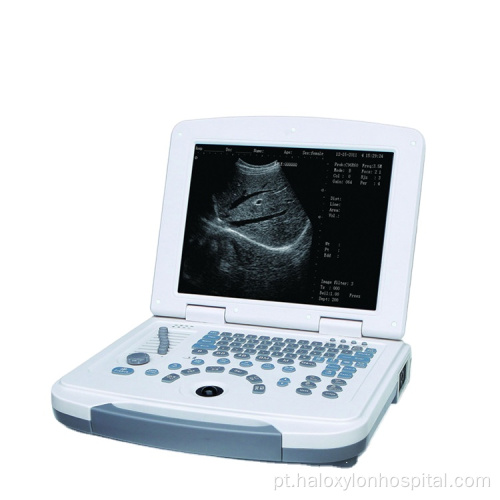 Exibir LED Vascular Laptop Ultrassom Scanner Preço